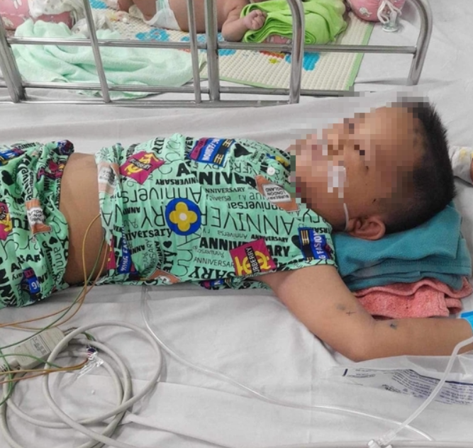 4 người ở Quảng Nam bị ong vò vẽ tấn công: Mẹ rơi vào cơn nguy kịch, 3 con nhỏ thương tích đầy người - Ảnh 4